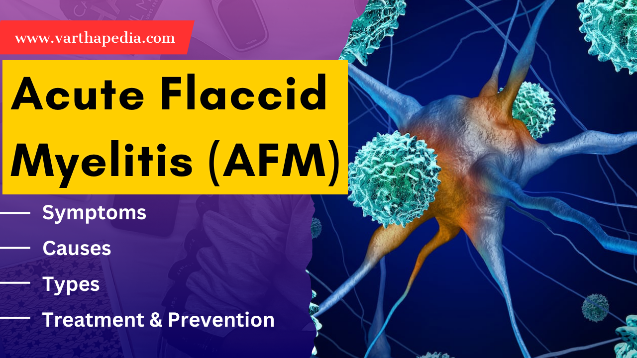 What causes acute flaccid myelitis [AFM]