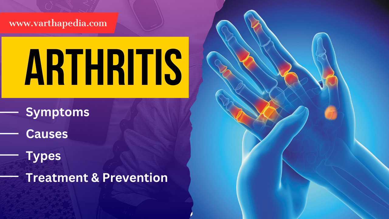 Arthritis